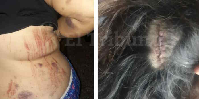 Accidente en ruta 68: Ale Hnos. le pide a una víctima el boleto para reconocerle remedios