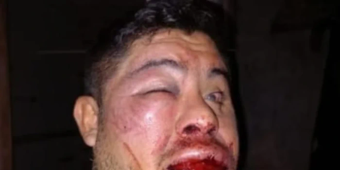 El agredido, Sebastián Fernández