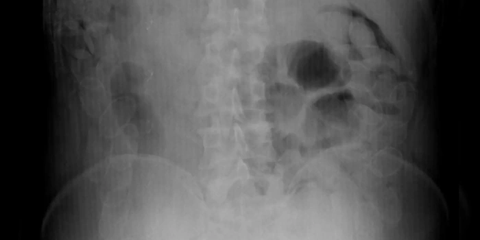 Se tragó más de 90 cápsulas con cocaína y pretendía traficarlas hasta Buenos Aires 