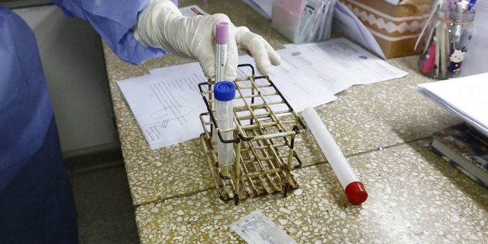 Reporte diario de COVID-19